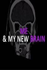 Watch Me & My New Brain 123movies