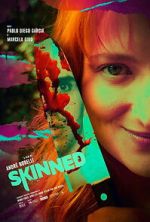 Watch Skinned 123movies