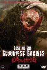 Watch TNA Wrestling: Best of the Bloodiest Brawls - Scars and Stitches 123movies