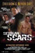 Watch Serbian Scars 123movies