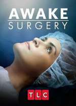 Watch Awake Surgery 123movies